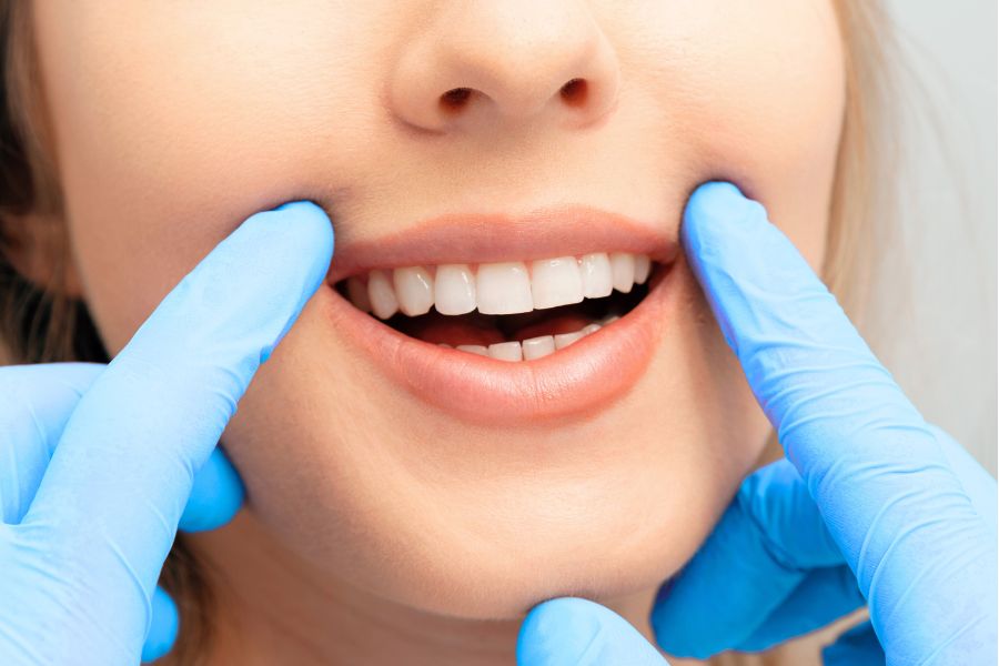 Cavity Filling Benefits