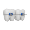 Braces & Aligners