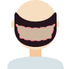 FUE Hair Transplant