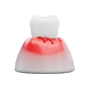 Gum Problems