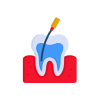 Root Canal