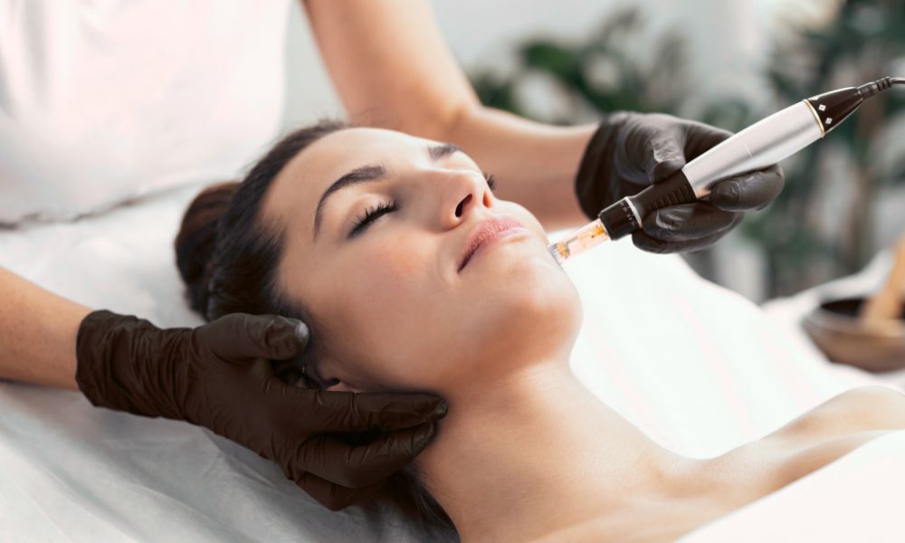 Chemical Peels