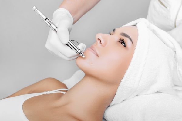 Chemical Peels