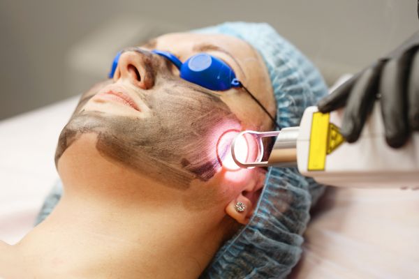 Laser Skin Resurfacing