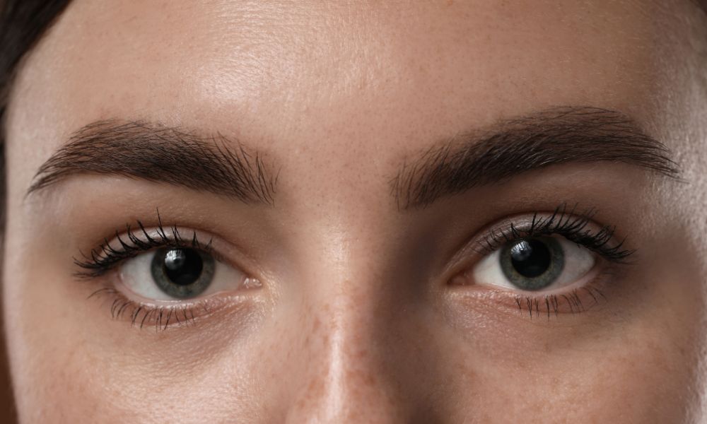 Eyebrow Transplant at Cherian Clinic