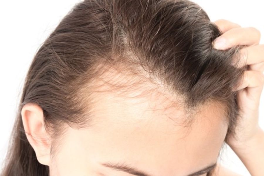 Skin Aging and Damage