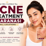 Acne Treatment in Varanasi – All Locations | Cherian Clinic