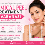 Chemical Peel Treatment in Varanasi