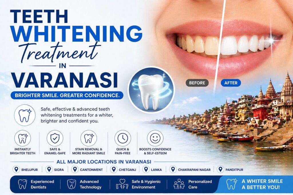 Choosing Teeth Whitening Treatment in Varanasi – All Locations | Cherian Clinic offers several advantages, especially when performed by experienced dental professionals.