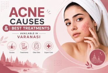 Acne Causes and Best Treatments Available in Varanasi | Cherian Clinic