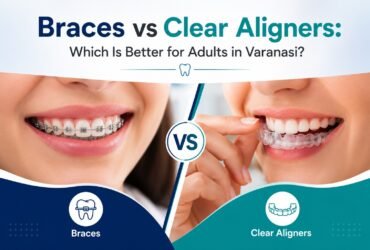 Braces vs Clear Aligners: Which Is Better for Adults in Varanasi? Braces vs Clear Aligners: Which Is Better for Adults in Varanasi?
