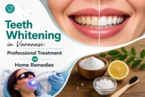 Teeth Whitening in Varanasi: Professional Treatment vs Home Remedies